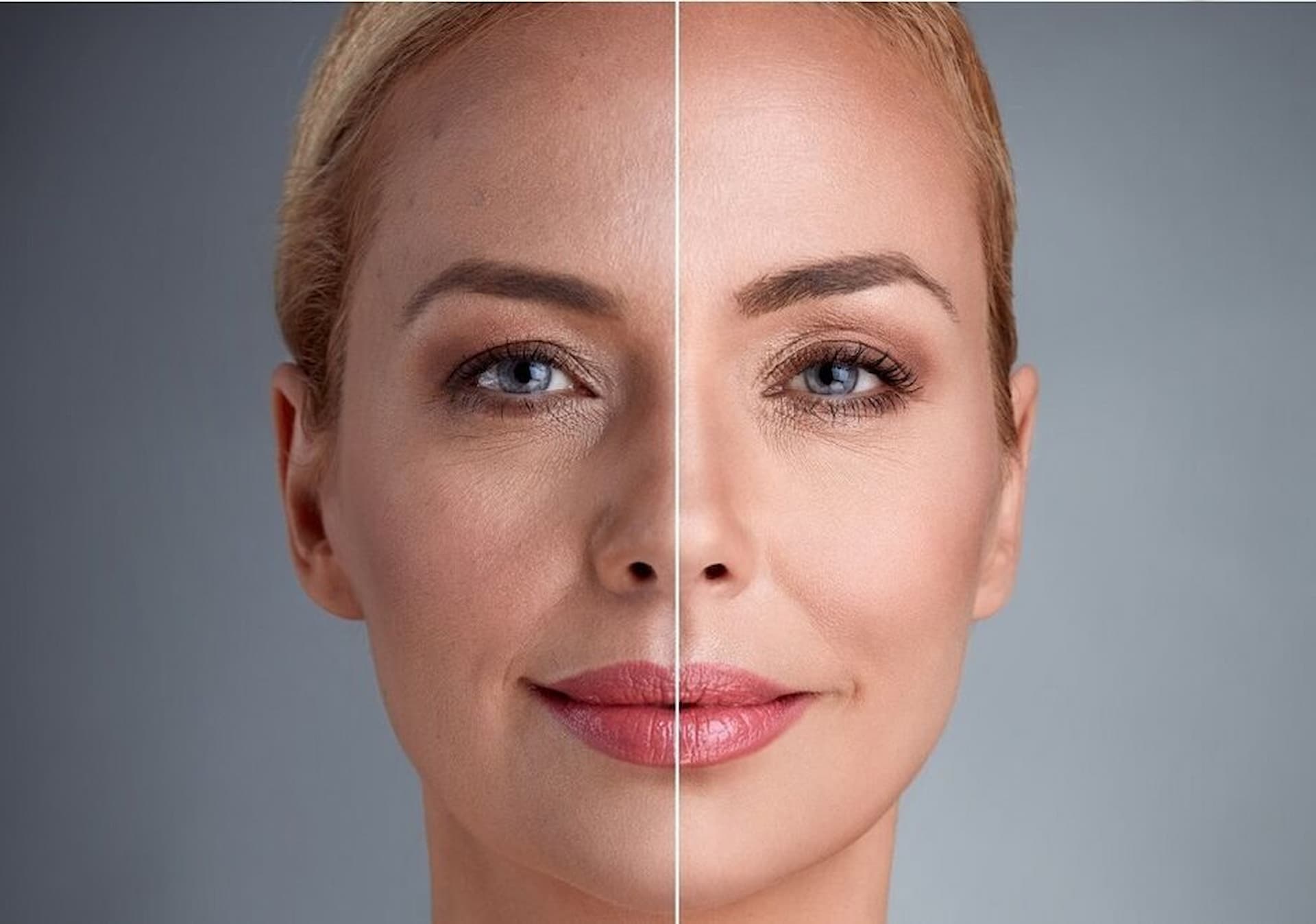 anti-wrinkle-2