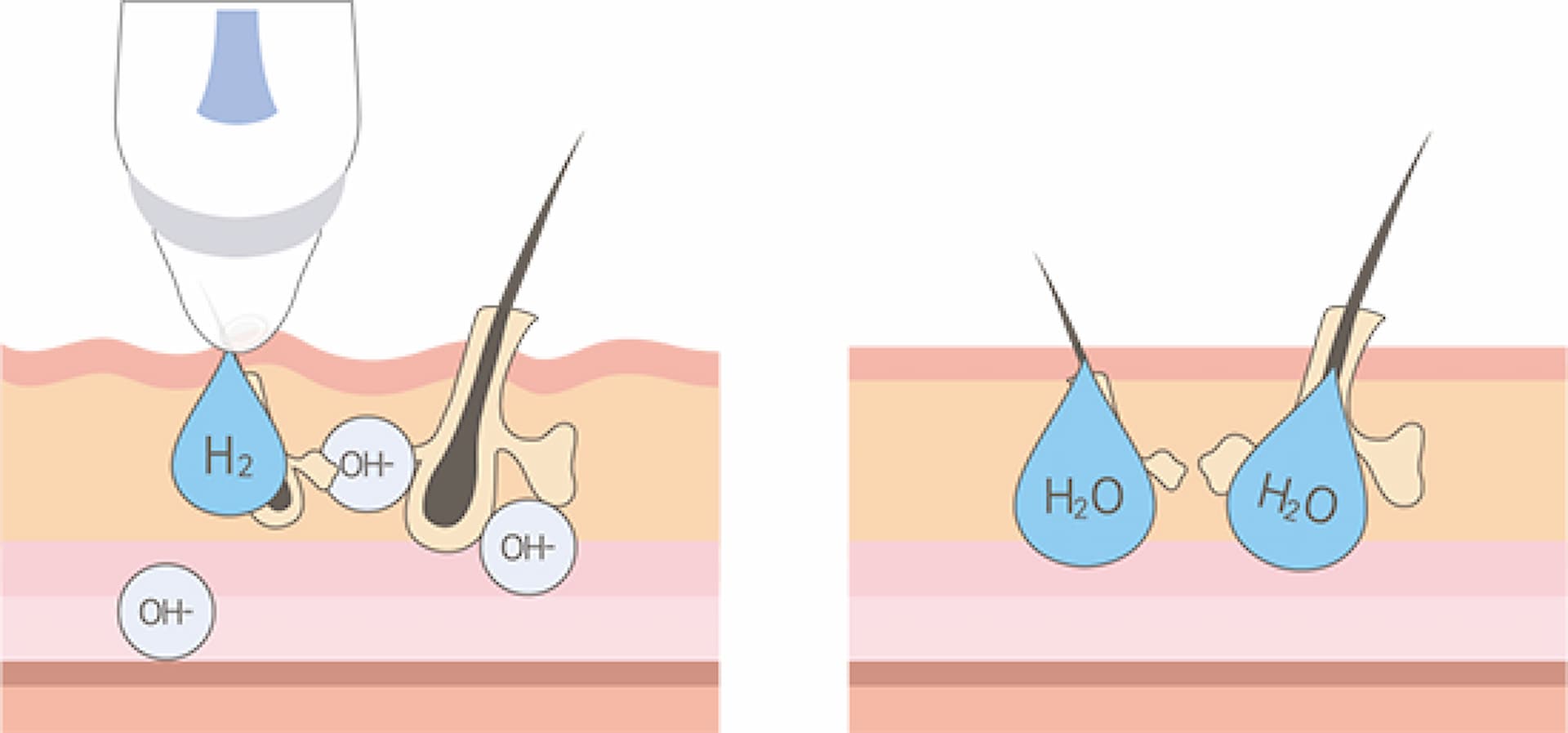 hydrafacial-2