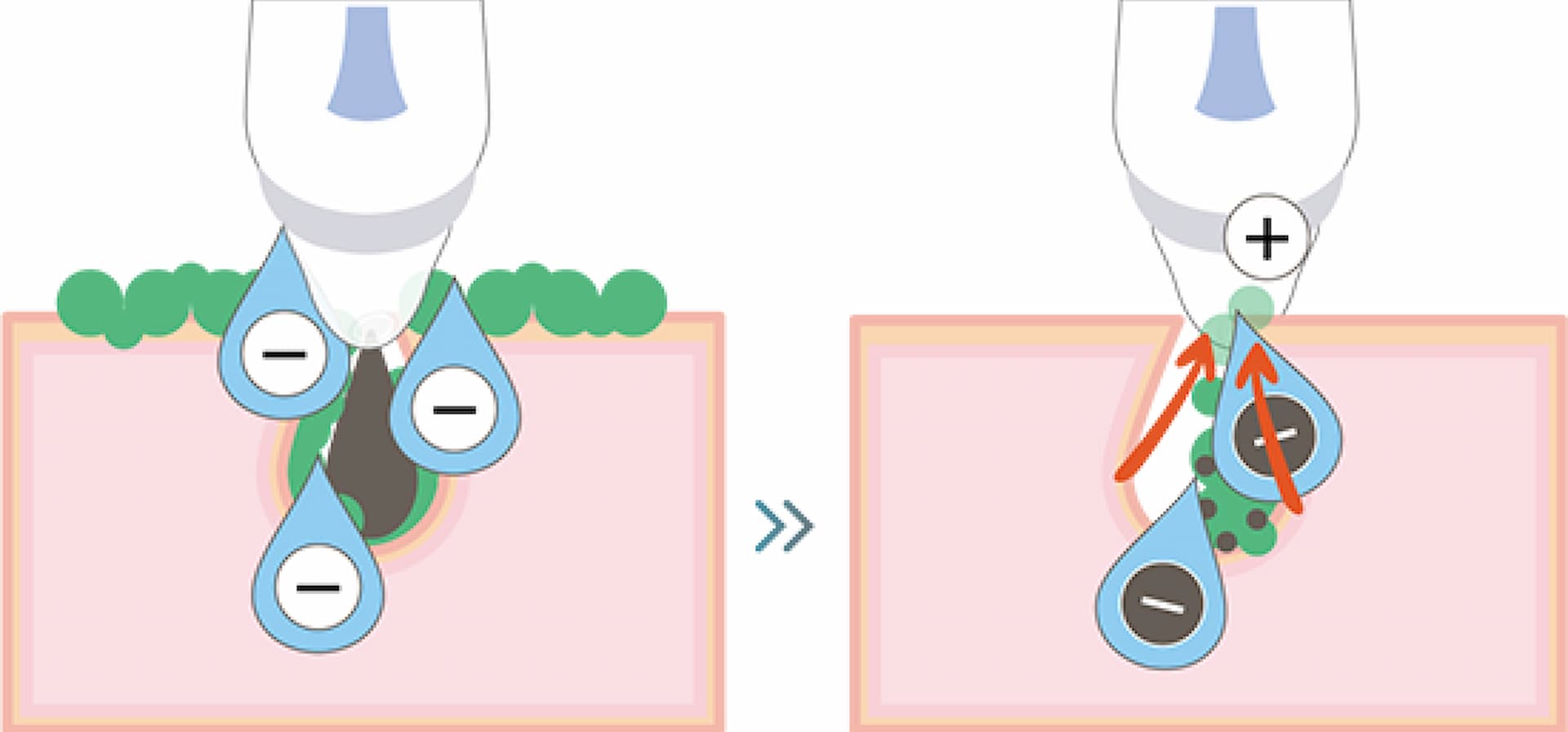 hydrafacial-3