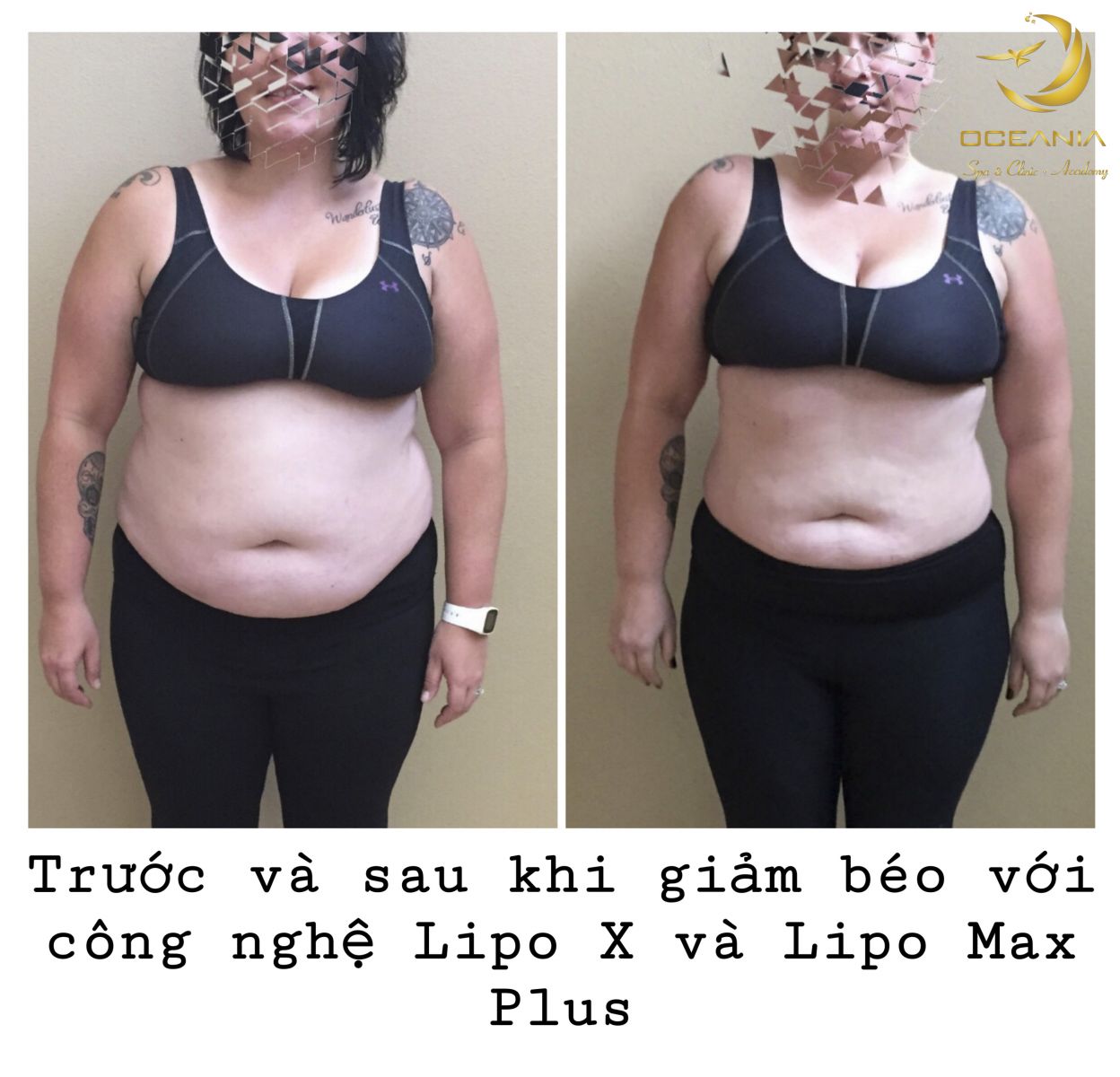 lipomax-plus-15-7-2