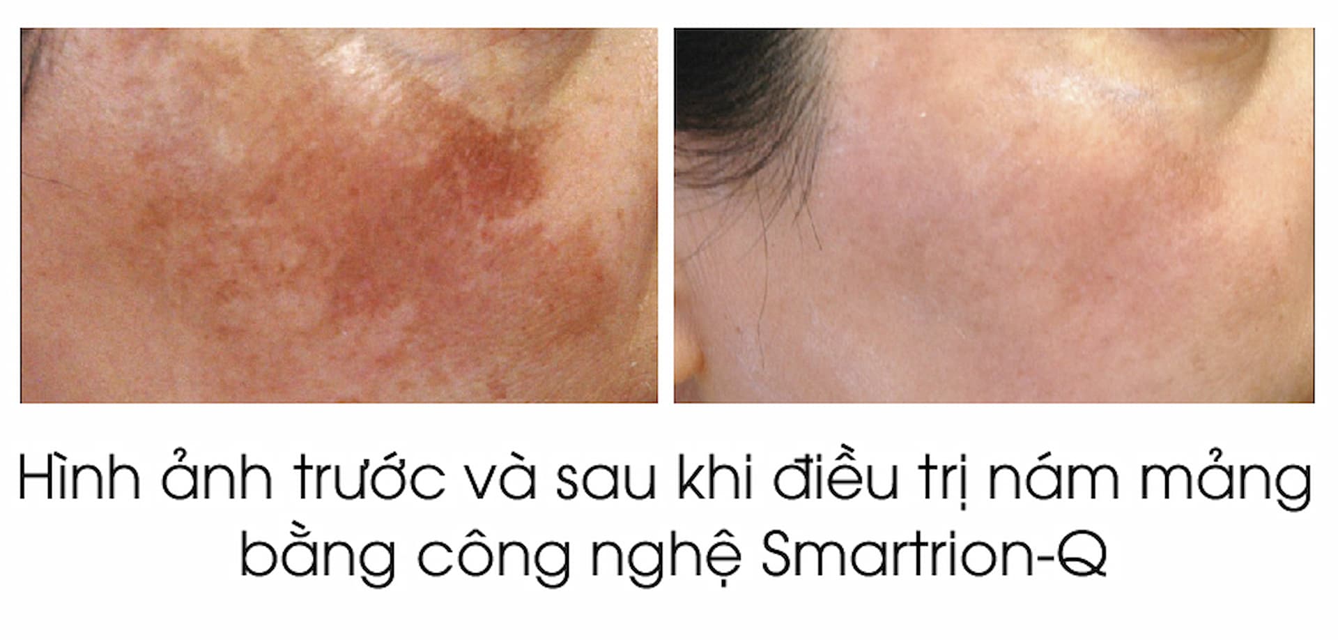smart-q-3